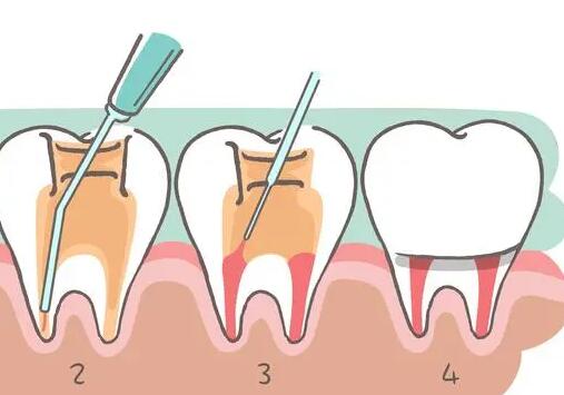 三明私人牙科診所哪家專業？瑞爾、博悅、貝恩口腔種植、正畸可供參考